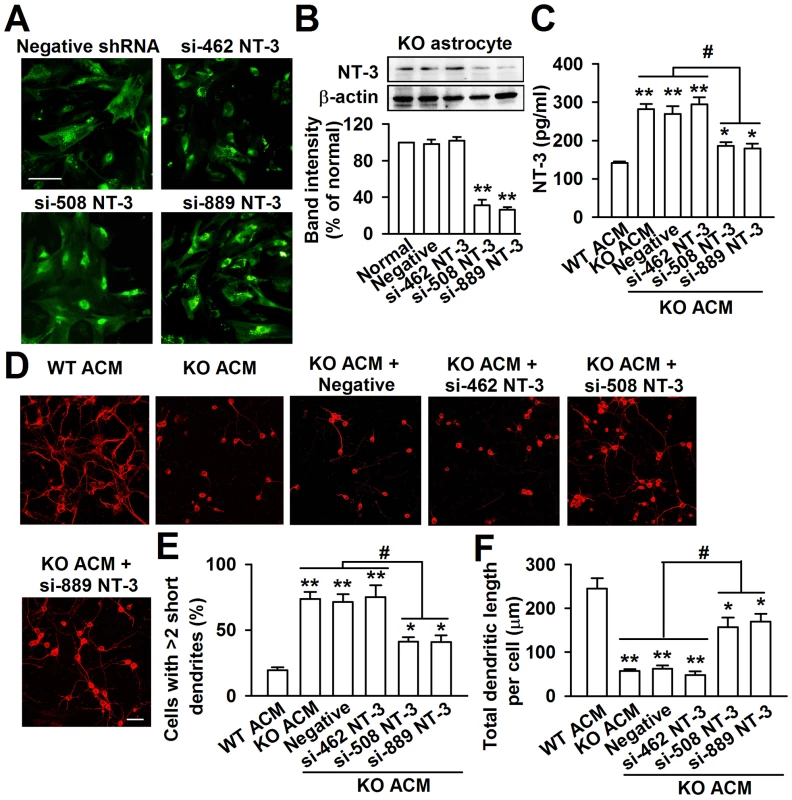 Knockdown of NT-3 in <i>Fmr1</i> KO astrocytes rescued aberrant neuronal morphology.
