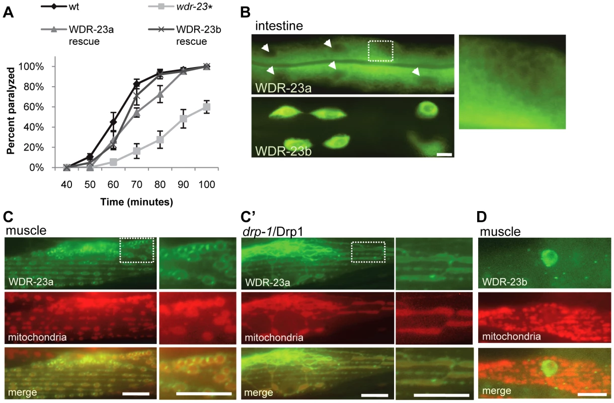 Subcellular localization and function of WDR-23 isoforms.