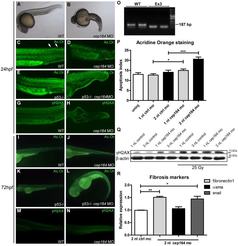 Apoptosis, DNA damage signaling and fibrosis in zebrafish.