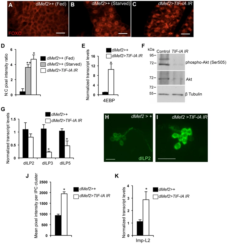 Muscle-specific TIF-IA inhibition reduces systemic insulin signaling.