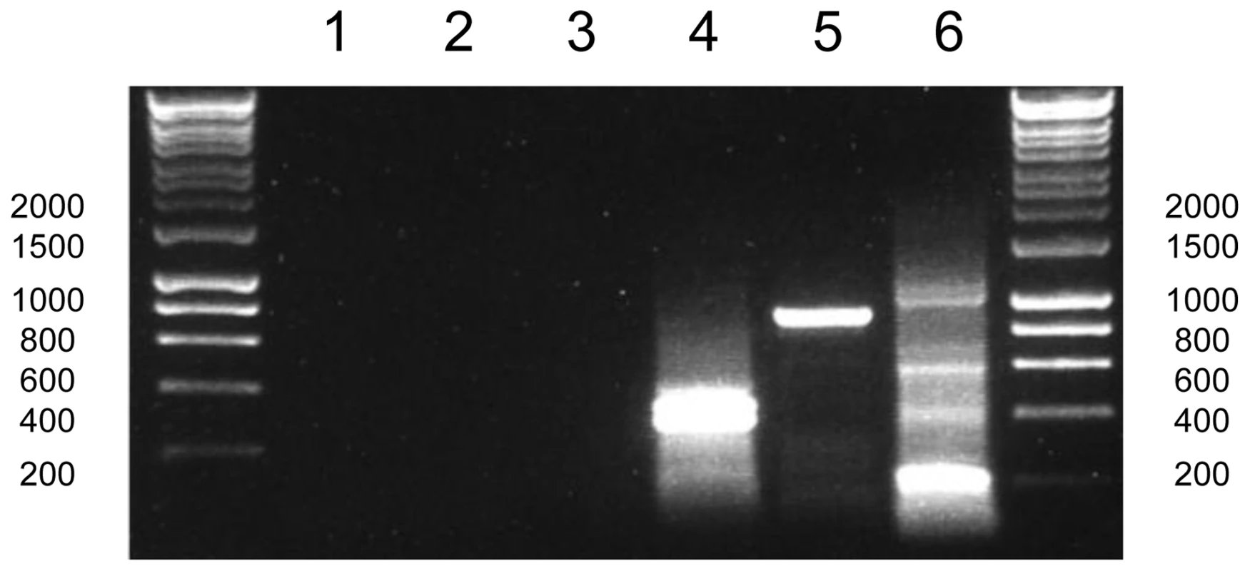 Poly(U) tails are not added to apicoplast transcripts in <i>Plasmodium falciparum</i>.