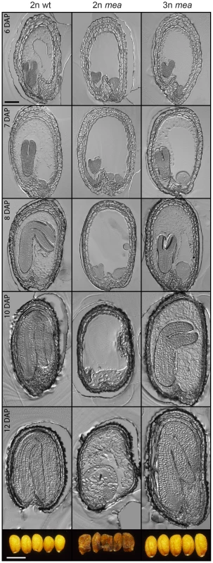 Endosperm Cellularization Is Restored in Triploid <i>mea</i> Seeds.