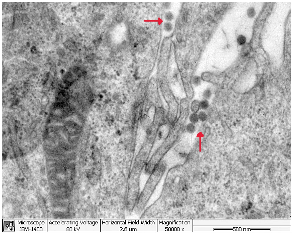 Thin-section electron microscopy of novel FTLS-associated bunyavirus Grown in Vero E6 Cells.