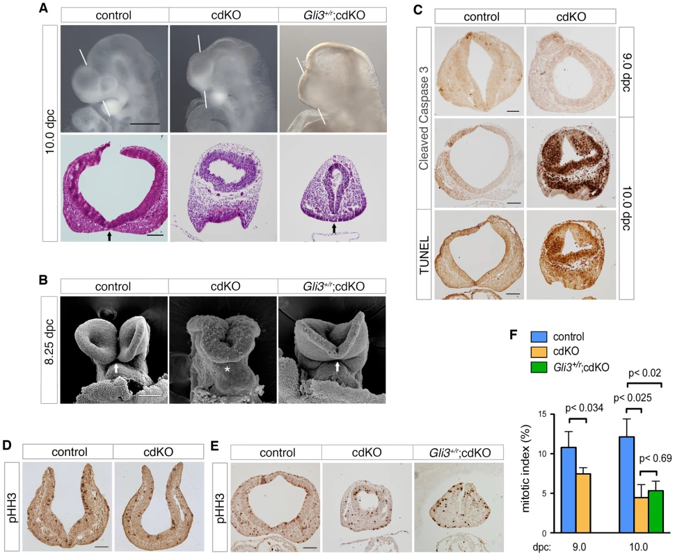 Rescued ventral forebrain structure in <i>Gli3</i> mutant cdKO embryos.