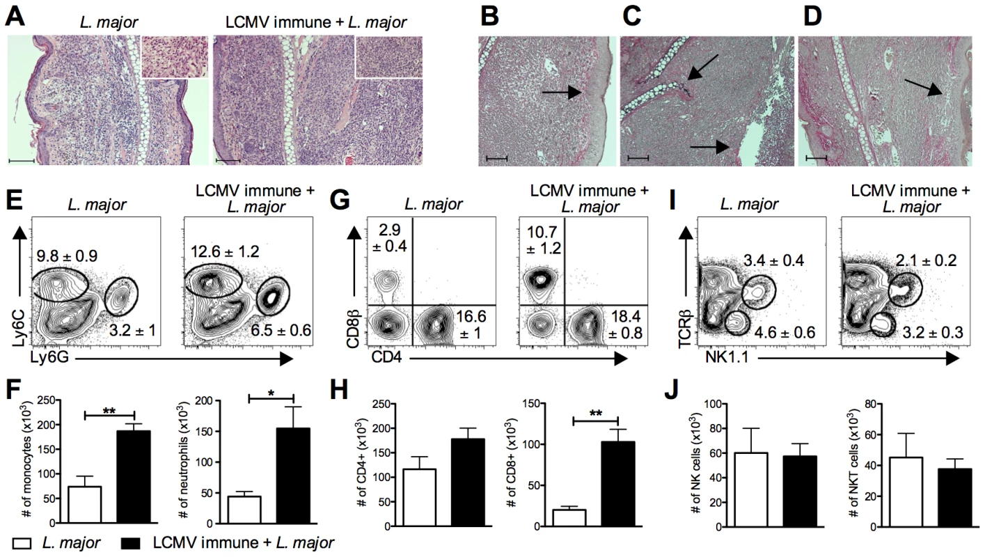 Increased cellular infiltration into the lesion of LCMV immune <i>L. major</i> infected mice.