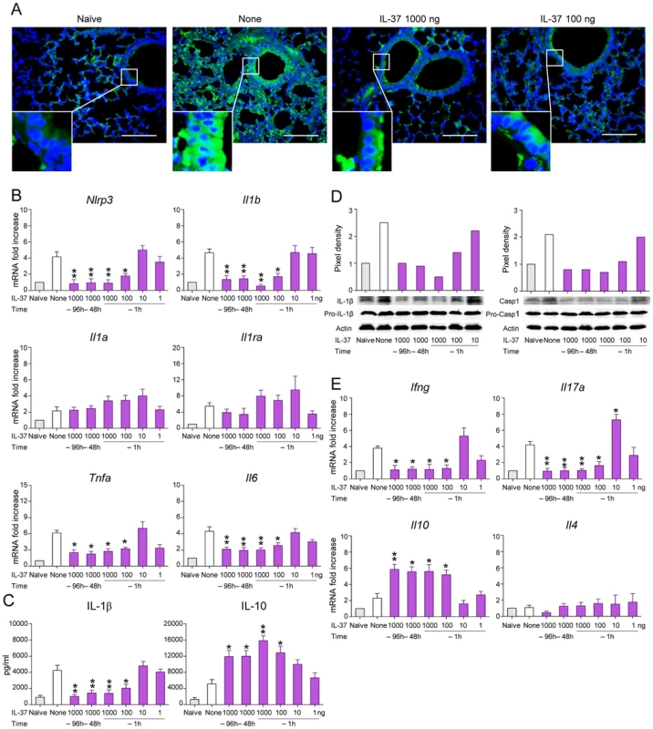 IL-37 impairs inflammasome activation in mice with aspergillosis.