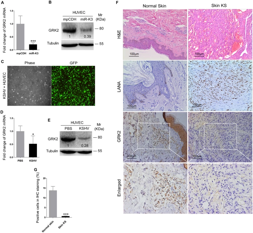 GRK2 expression is reduced in miR-K3-expressing HUVEC and KS lesion samples.