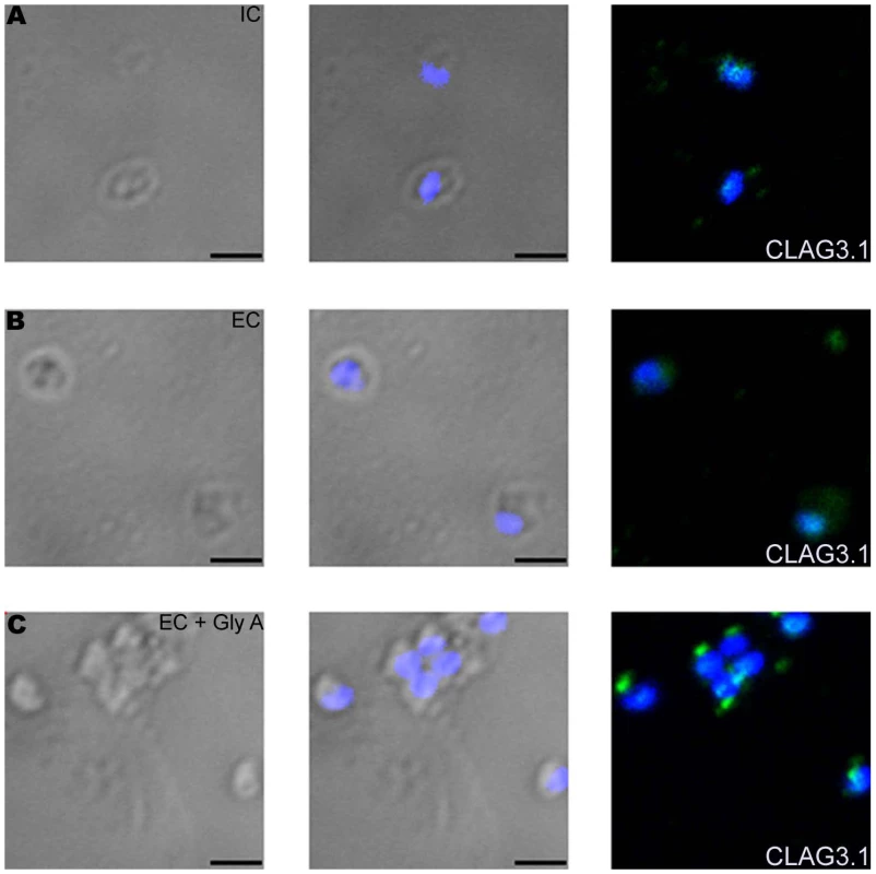 Expression of CLAG3.1 on merozoite surface detected by immunofluorescence assay (IFA) in response to interaction with glyA.