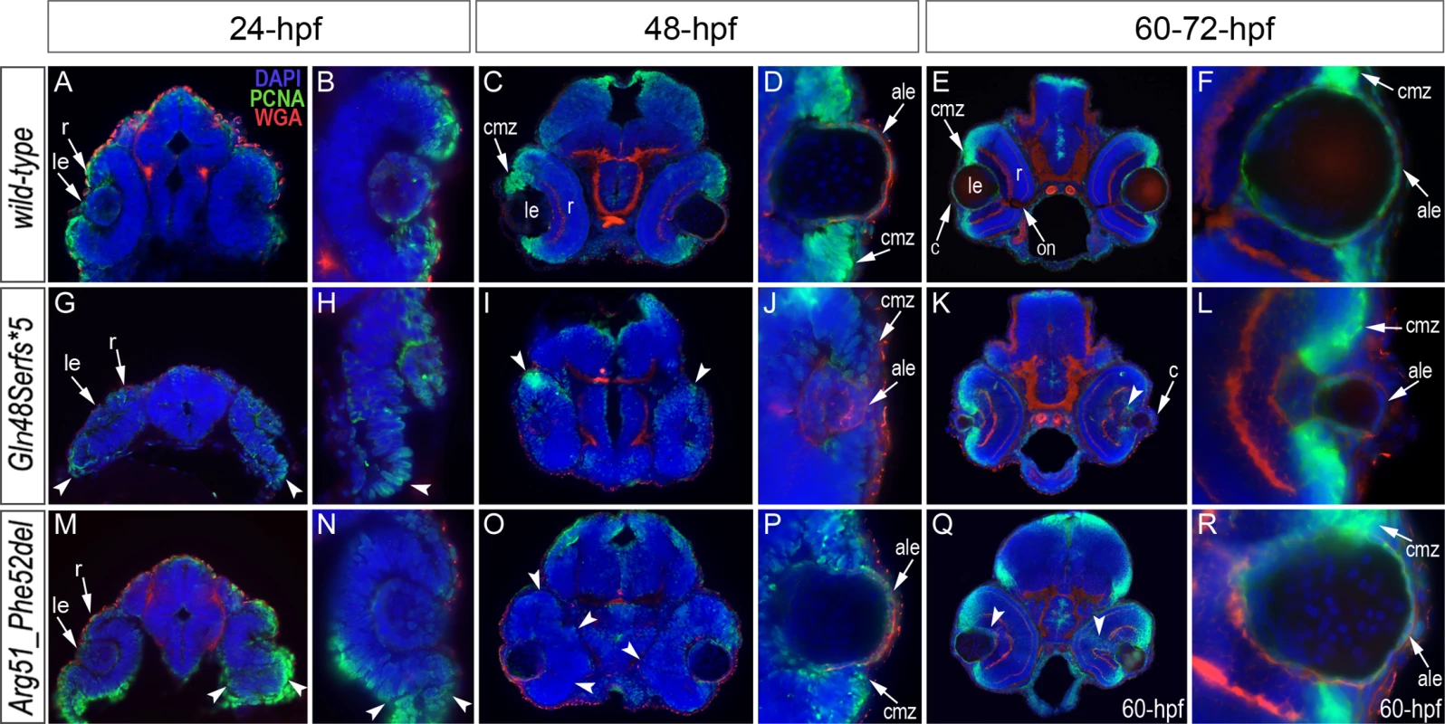 Analysis of proliferation patterns and differentiation markers in wild-type and mutant embryos.