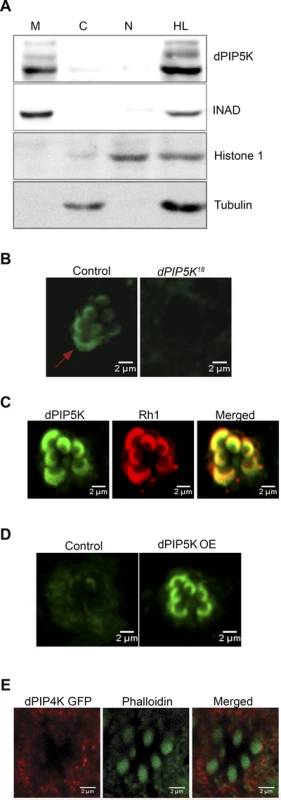 Subcellular localization of different PIPKs in adult photoreceptors.