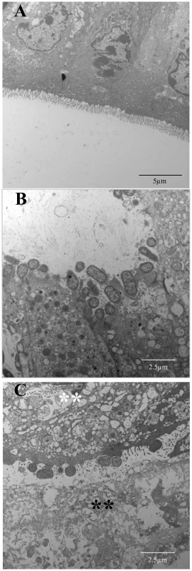 Transmission Electron Microscopy of the intestinal tissues of mice infected with <i>C. rodentium</i> or its orf02851 mutant.