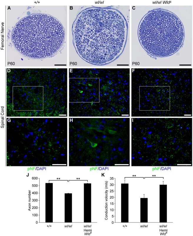 The <i>Wld<sup>s</sup></i> mutation delays axonal degeneration in <i>wl</i> (<i>wl/wl</i>) mice.