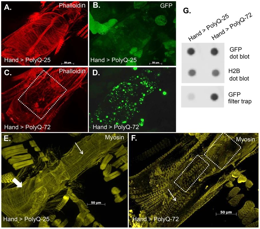 Mutant PolyQ causes structural defects and GFP-positive aggregates in the fly heart.