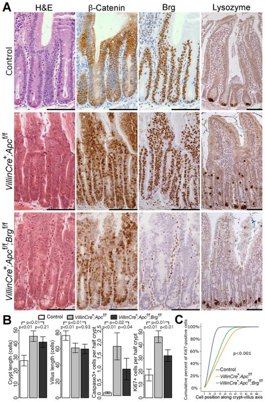 Brg1 loss attenuates the effects of Apc deletion in the small intestinal epithelium.