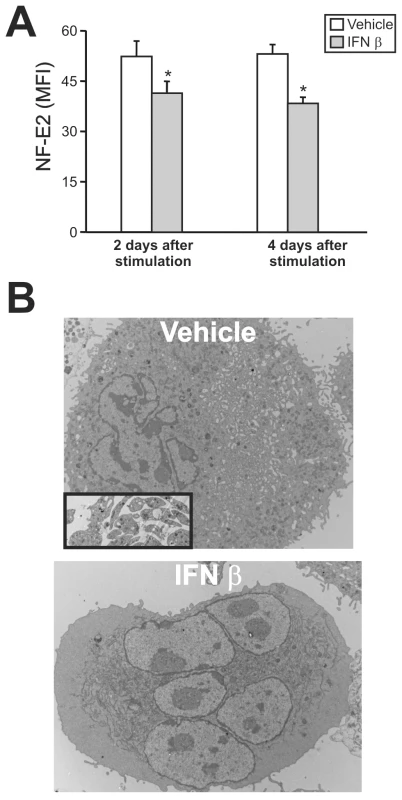 NF-E2 expression and ultrastructural studies of megakaryocytes treated with IFN β.