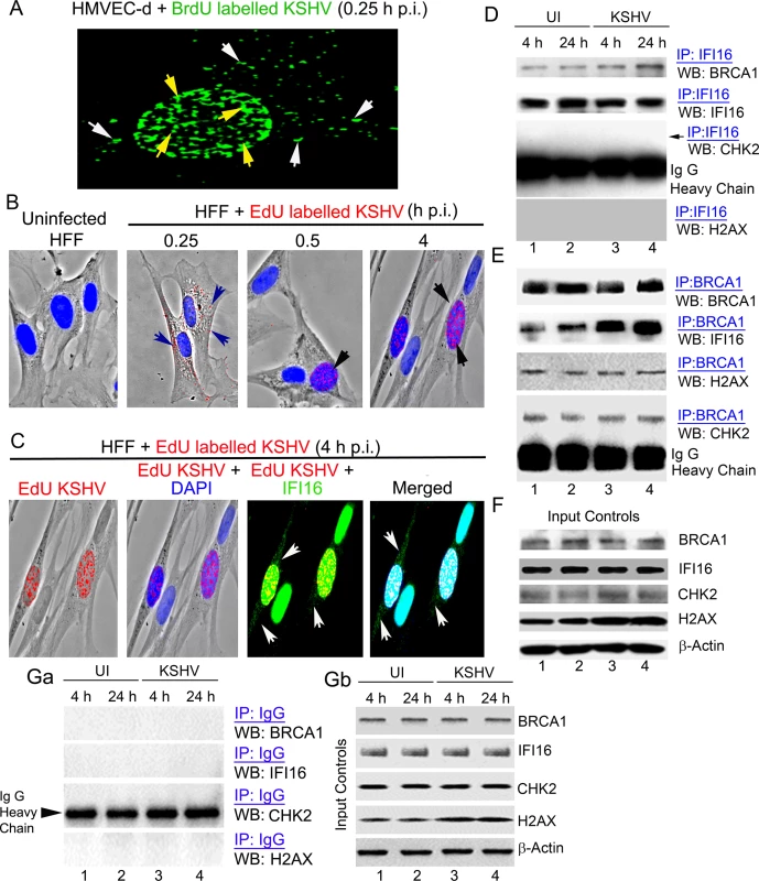 Enhanced interaction of IFI16 with BRCA1 but not with other DNA damage response proteins during <i>de novo</i> KSHV infection.