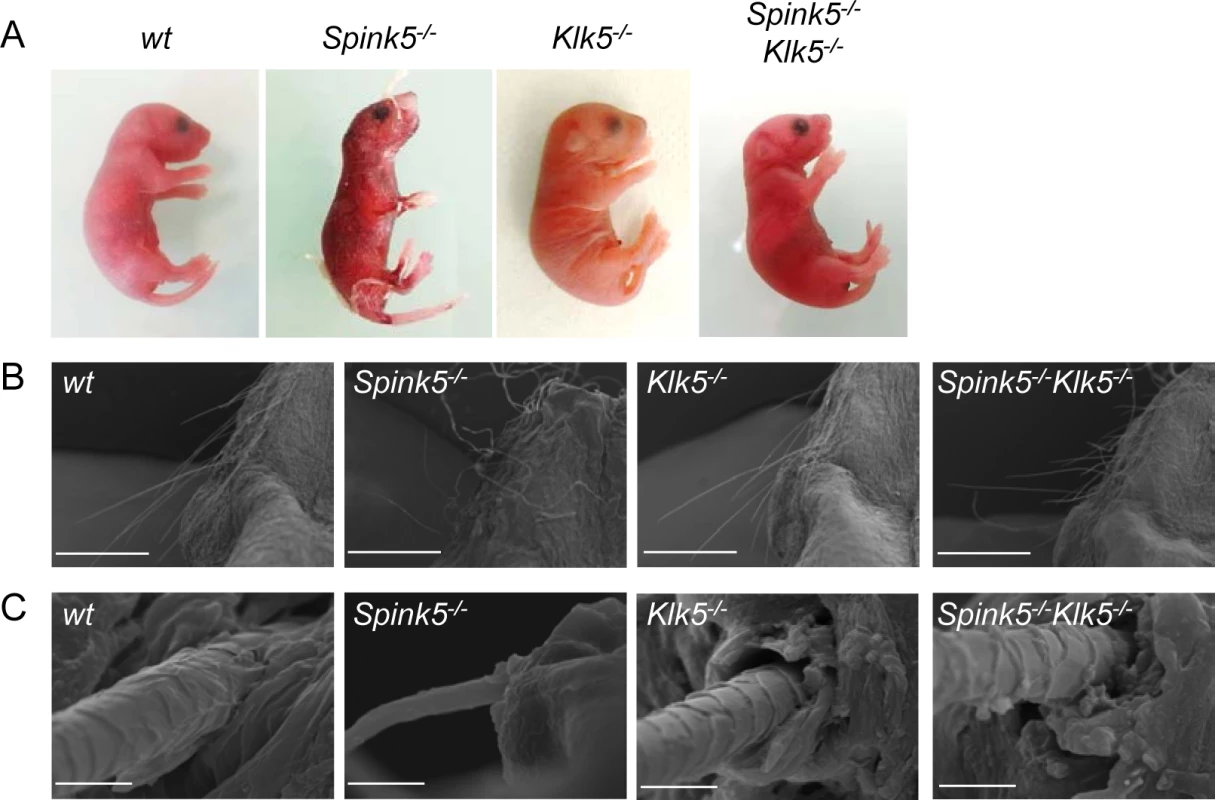 Loss of <i>Klk5</i> expression reverses skin and whisker anomalies in <i>Spink5</i><sup><i>-/-</i></sup> mice.