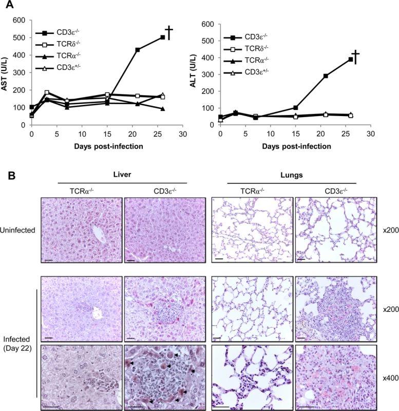 γδ T cell control of MCMV infection is associated with reduced organ damage.
