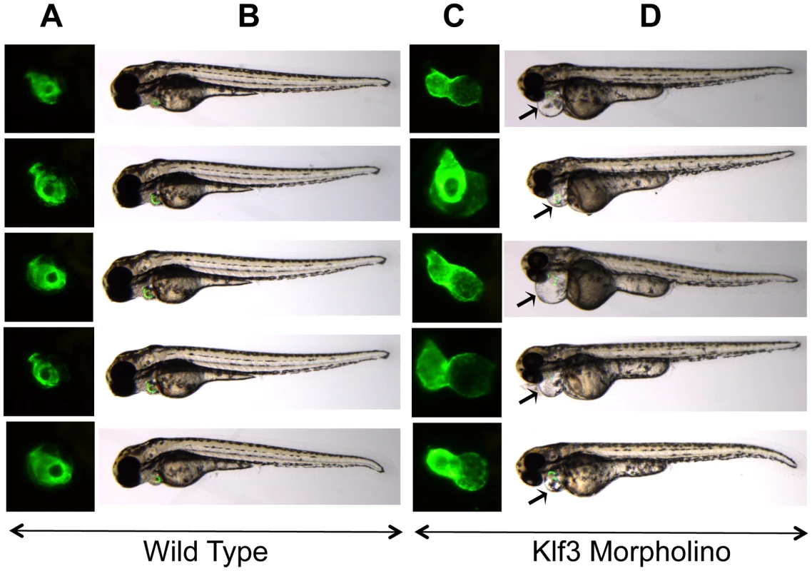 Cardiac edema in zebrafish embryos injected with <i>klf3</i> morpholinos.