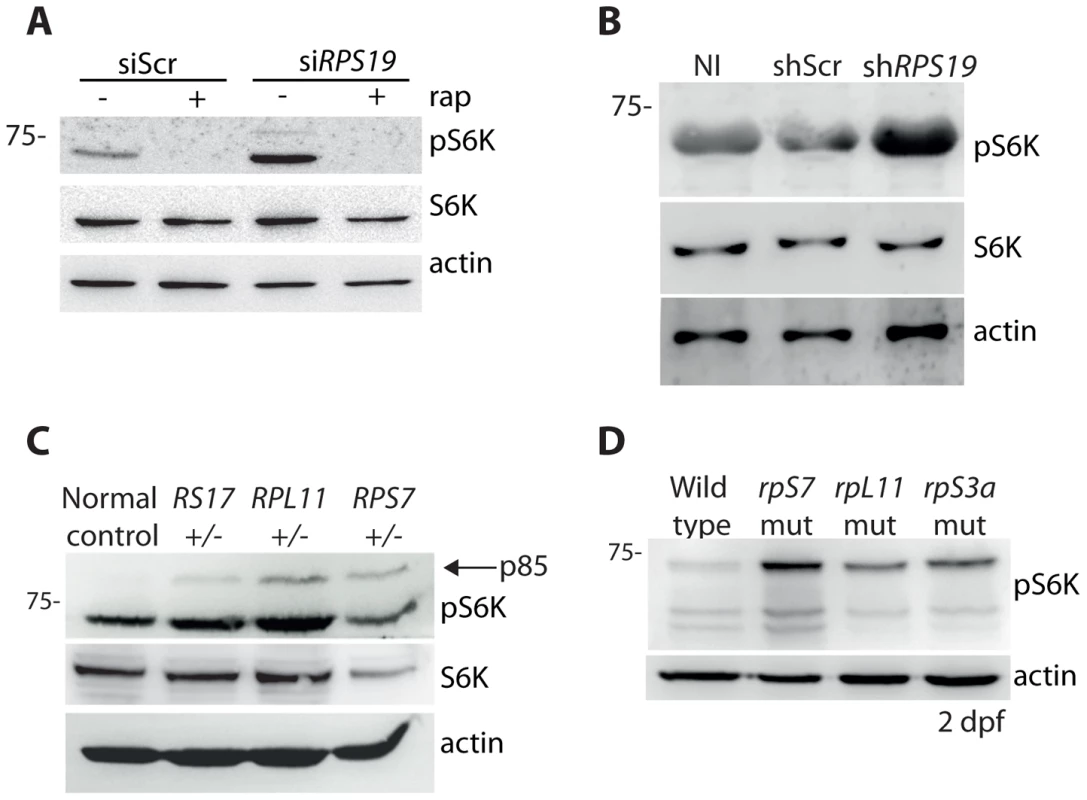 RP loss increases phospo-S6 kinase signaling.