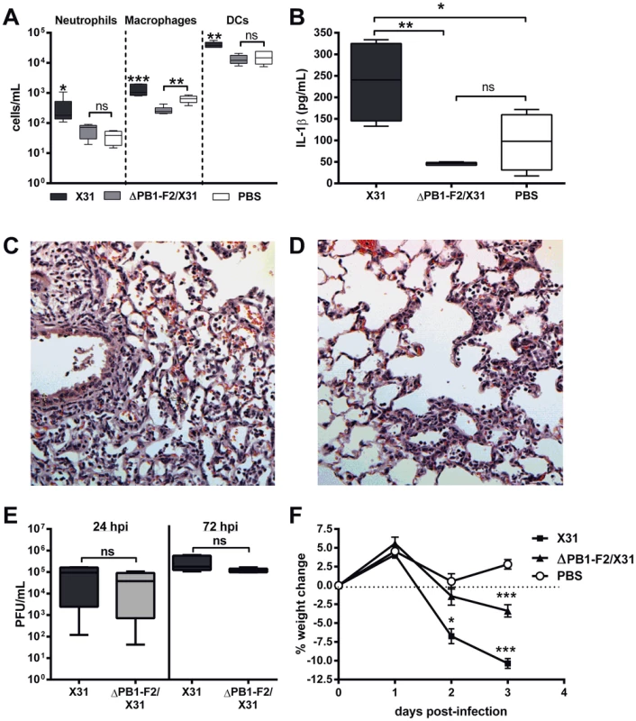 PR8 PB1-F2 increases cellularity and IL-1β secretion during infection in the lungs.