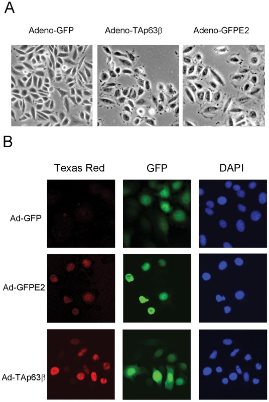 E6/E7 repression by E2 and ectopic expression TAp63β induce phenotypic changes in SiHa cells.