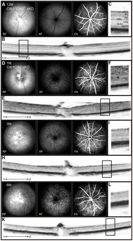 <i>In vivo</i> retinal imaging in <i>Crb1Crb2</i> cKO mice.