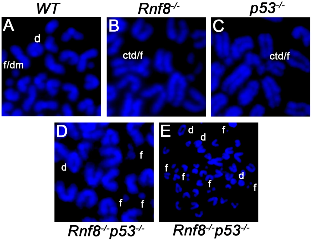 Representative chromosomal abnormalities observed in activated B-cells from <i>Rnf8<sup>−/−</sup>p53<sup>−/−</sup></i> mice and control littermates.