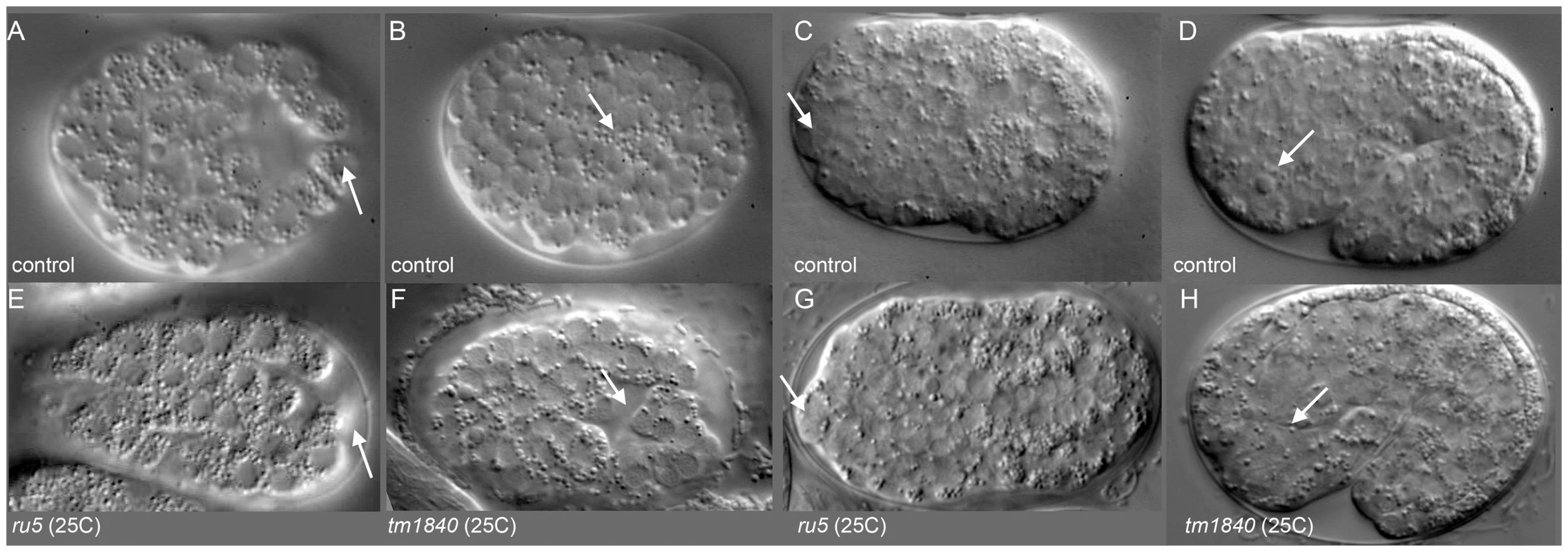 <i>pmr-1</i> mutant embryos show differences in the positioning of cells during and after gastrulation.