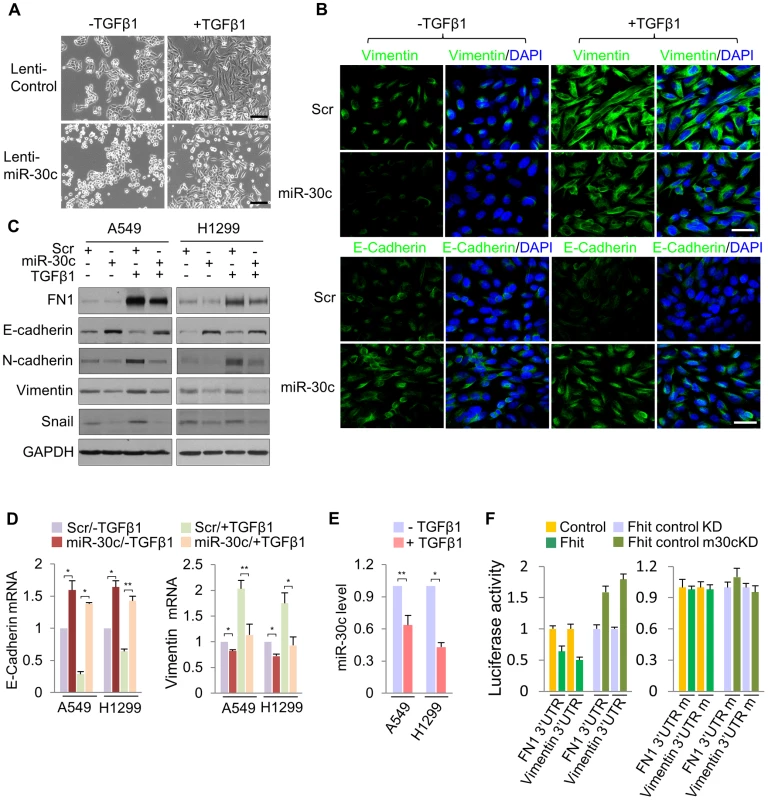 miR-30c inhibits TGF-β-induced EMT through direct targeting of Vimentin and Fibronectin.
