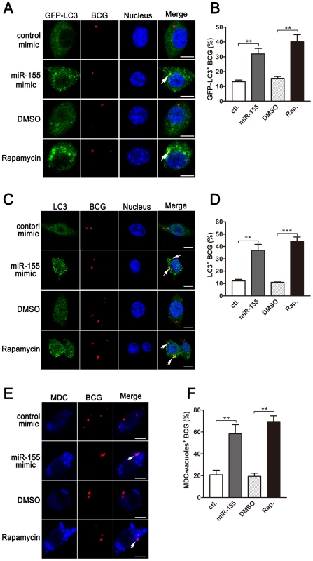 miR-155-induced autophagy promotes the formation of mycobacterial autophagosomes.