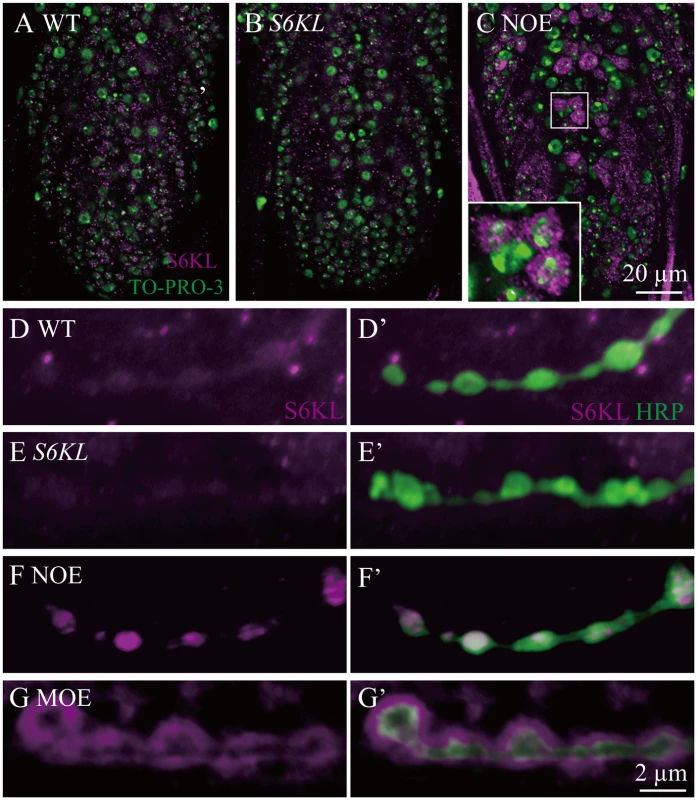 Overexpressed S6KL enriches in pre- and postsynaptic area.