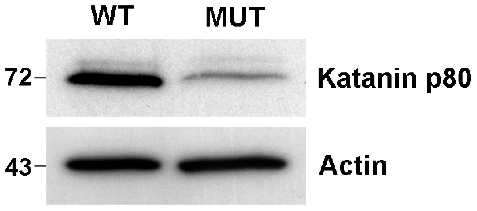 Reduction in katanin p80 protein in haploid germ cells from <i>Katnb1<sup>Taily/Taily</sup></i> mice.