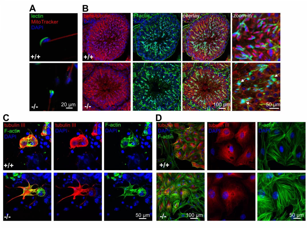 Lack of GBA2 causes globozoospermia and cytoskeletal defects in the testis.