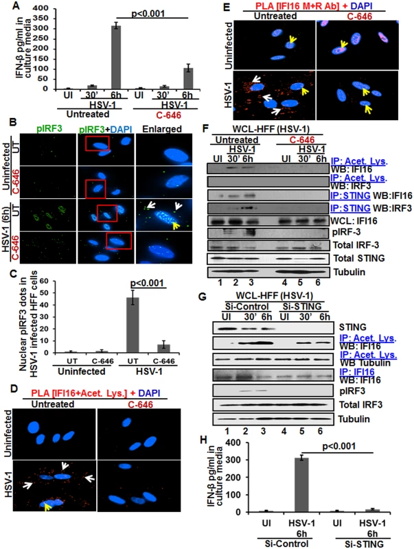 Effect of IFI16 acetylation on IFN-β production during <i>de novo</i> HSV-1 infection in HFF cells The HFF cells uninfected or infected with HSV-1 (1 PFU/cell MOI) in the presence or absence of 1 μM C-646 for 30 min or 2 h were washed and incubated with or without 1 μM C-646 for 6 h.