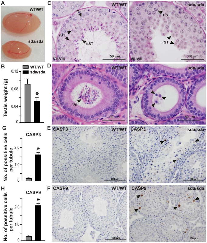 Spermatid differentiation arrest, germ cell sloughing and apoptosis lead to sterility in the <i>Rbm5<sup>sda/sda</sup></i> males.