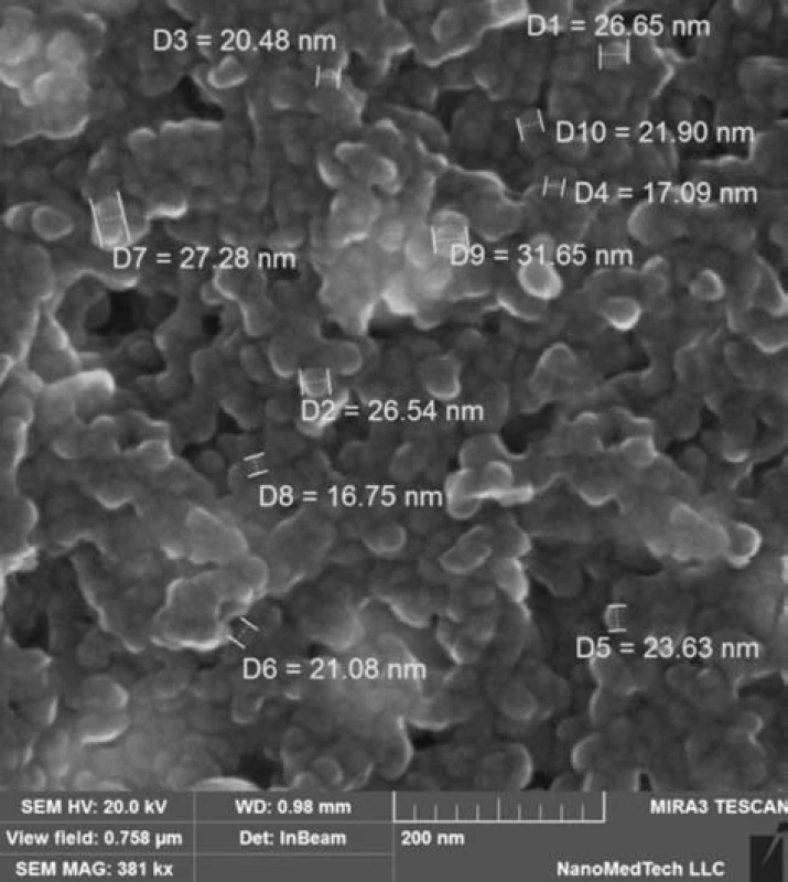 A picture of Ag@Fe&lt;sub&gt;3&lt;/sub&gt;O&lt;sub&gt;4&lt;/sub&gt; nanoparticles using an electron microscope