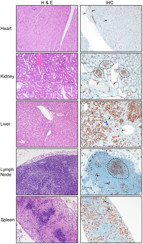 Histological analysis of peripheral organs from Andes virus infected hamsters.