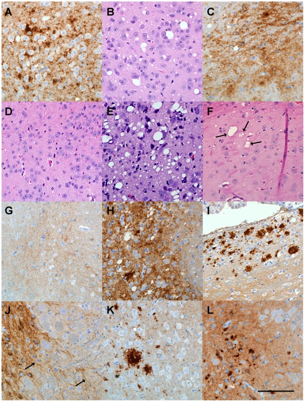 Histopathological analysis of brain tissue from transgenic mice inoculated with various scrapie strains.