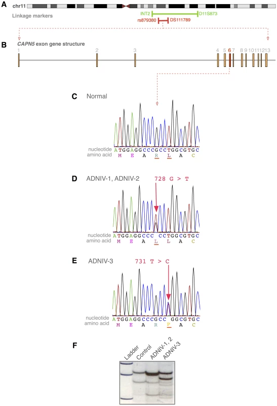 The <i>CAPN5</i> gene harbors mutations in exon 6 of ADNIV subjects.