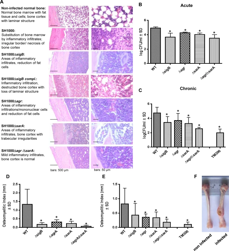 The interplay of <i>agr</i>, <i>sarA</i> and <i>sigB</i> is required to settle and maintain an infection in a local rat chronic osteomyelitis model.