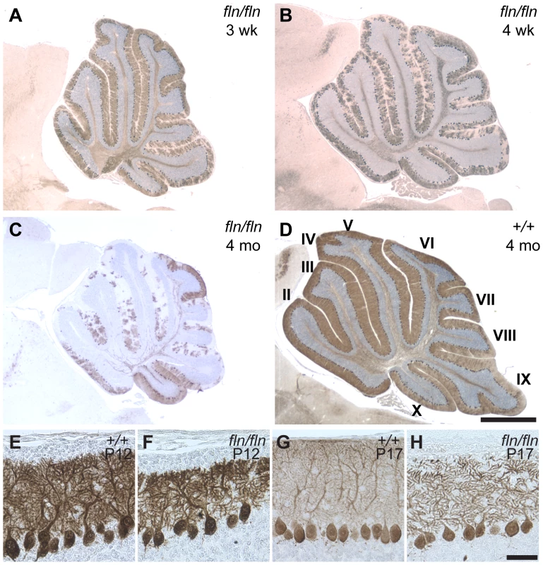 Progressive cerebellar Purkinje cell degeneration and abnormalities of Purkinje dendritic arbors in <i>fln/fln</i> mice.