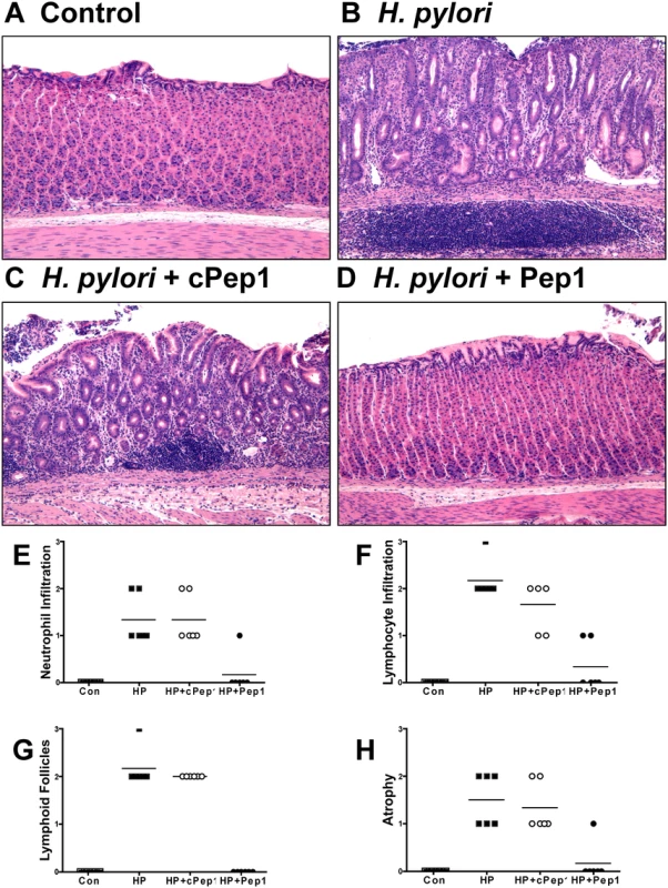 Inhibition of CD44 blocks the development of atrophic gastritis in <i>H</i>. <i>pylori</i> infected Mongolian gerbils.