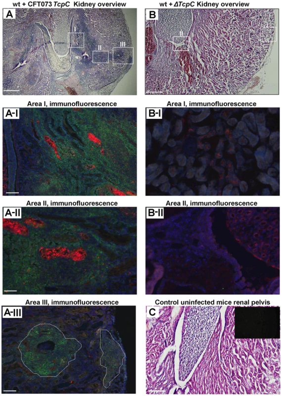 Deletion of TcpC abrogates abscess formation in kidney sections from wild type mice infected with CFT073.
