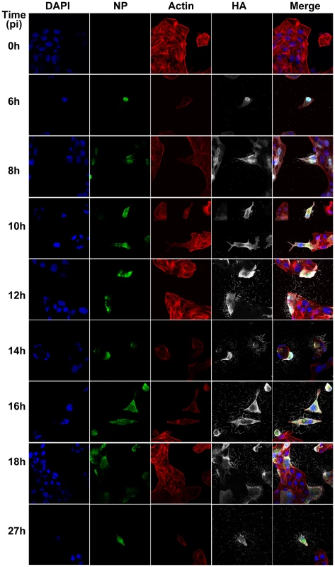 Time course immunofluorescence imaging of filament formation in MDCK cells infected with Influenza A/Udorn/72.