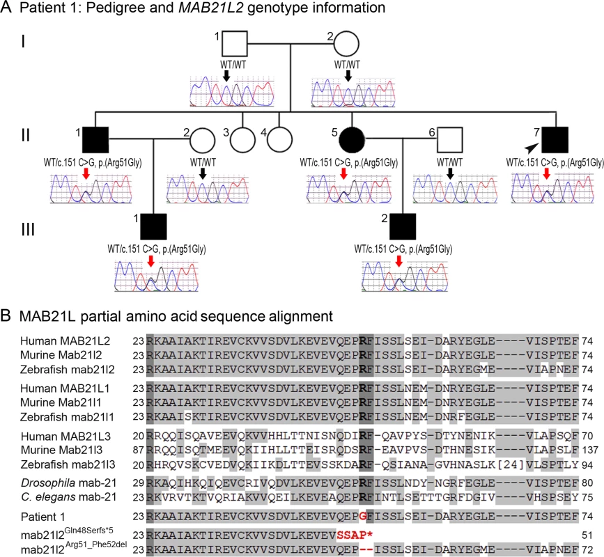 <i>MAB21L2</i> mutations and protein sequence conservation.