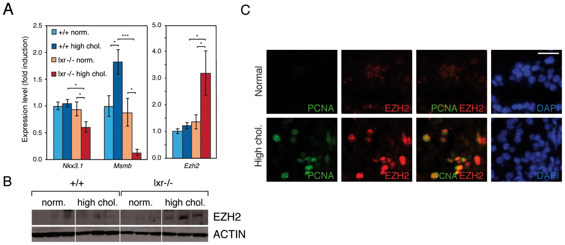 Disruption of cholesterol homeostasis induces the repression of <i>Nkx3.1</i> and <i>Msmb</i> tumor suppressor genes and upregulation of the <i>Ezh2</i> histone methyltransferase gene.