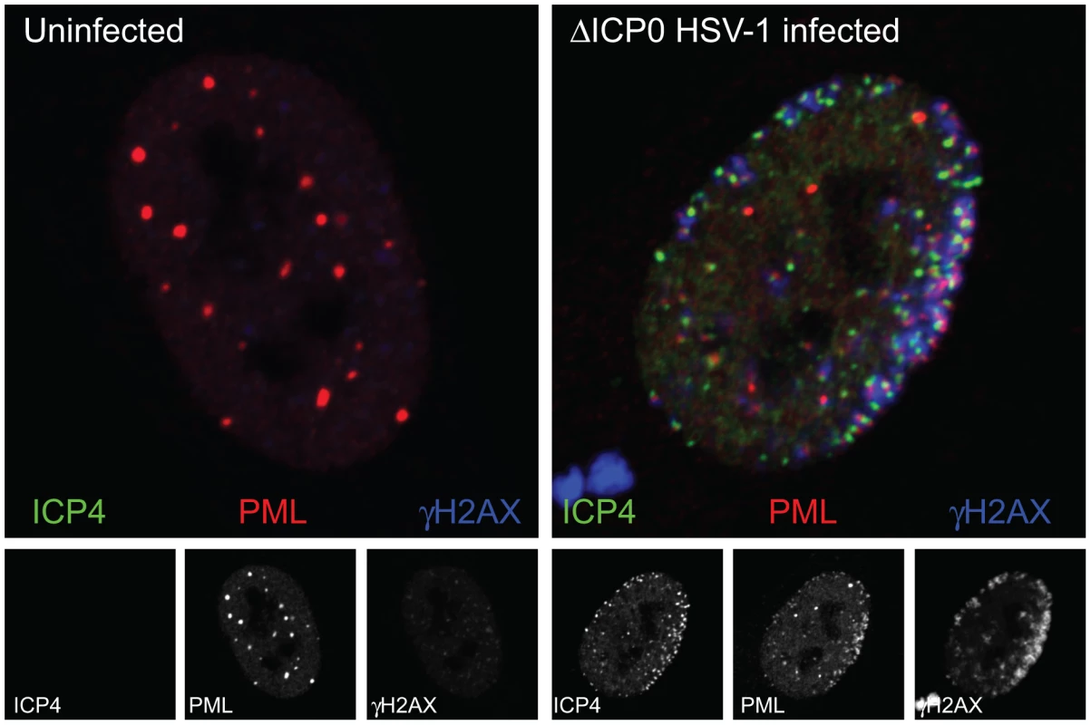 The association of PML and DNA damage response foci with HSV-1 genomes.