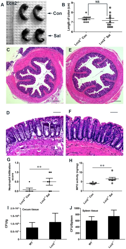 Lcn2<sup>−/−</sup> mice are markedly protected from <i>S.</i> Typhimurium-induced colitis.