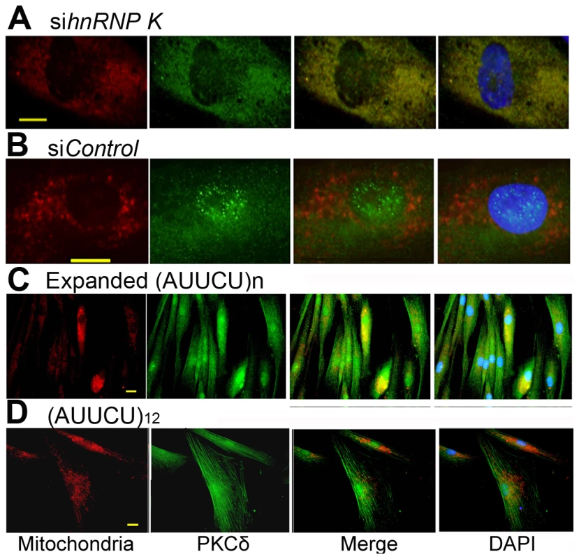 Targeted inactivation of <i>hnRNP K</i> in normal fibroblasts or expression of expanded AUUCU-RNA results in mitochondrial localization of PKCδ.